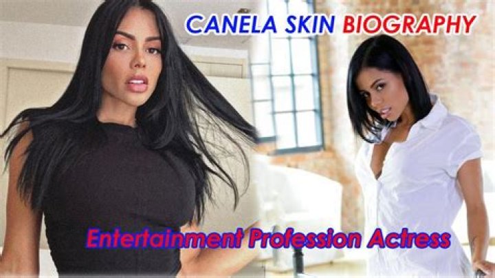 Canela Skin Biography, Age, Height, Family, Wiki & More