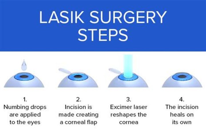 Epi-LASIK Eye Surgery - How Epi-LASIK Works, and What To Expect