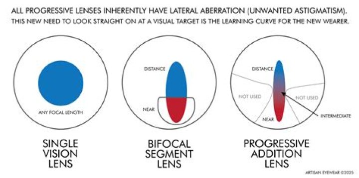 How Custom Contact Lenses Can Improve Your Vision