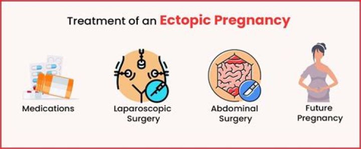 Is the treatment of ectopic pregnancies an abortion?