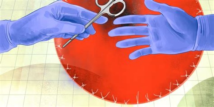 My First Cut Was with Suture Scissors, Not a Scalpel