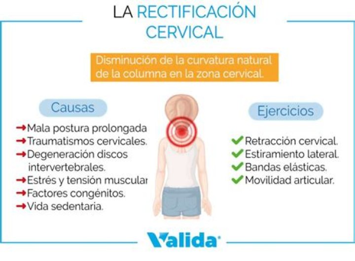 por qué la rectificación cervical puede ser la causa